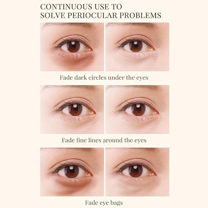 24k Gold Under Eye Patches - 60 Pcs Gold Eye Mask Anti-Aging, Under Eye Mask for Removing Dark Circles, Puffiness, Wrinkles.