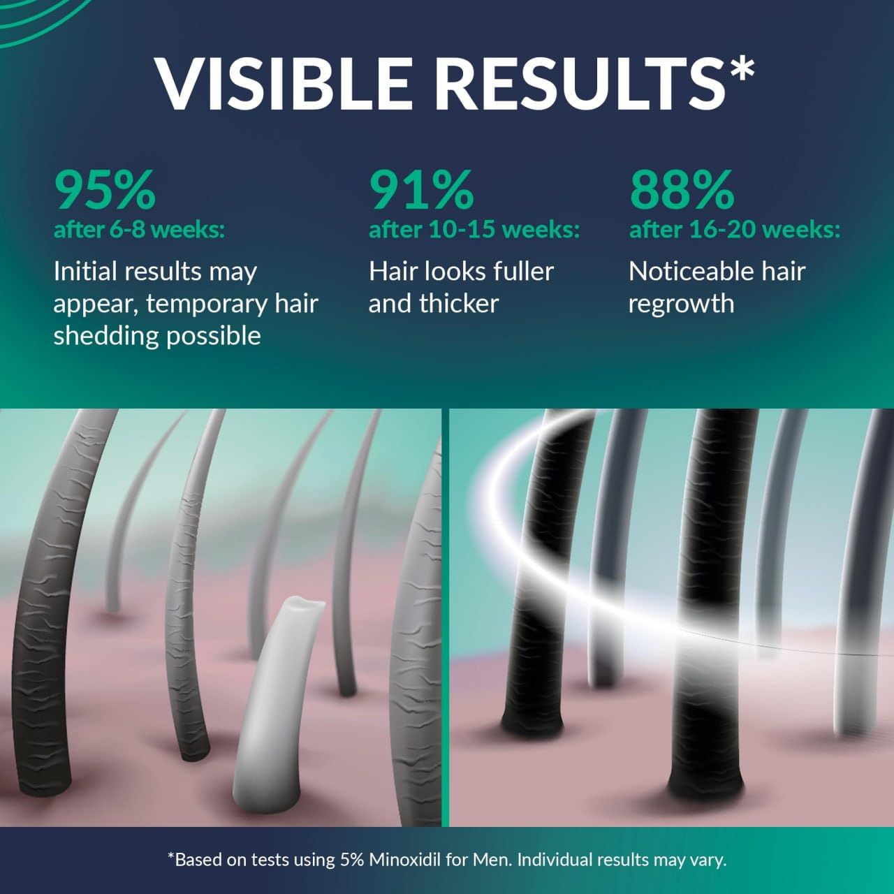 Minoxidil for Men 5% - Hair Growth, Beard Growth Kit Minoxidil 5 Percent + Vitamin E, Ginseng, Ginger Extract, Biotin Hair Growth Serum - Anti Hair Loss, Regrowth Treatment