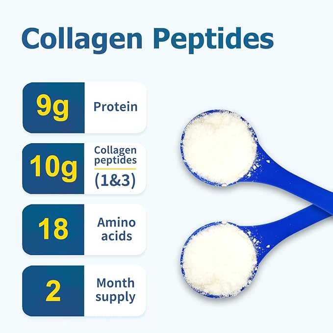 Zammex Premium Collagen Peptides Powder,Hydrolyzed Collagen Peptide for Women Men,Support for Hair Skin Nails, Joints Health,Grass Fed,Non-GMO,Keto Friendly,Gluten-Free,Easy to Digest,30 Servings