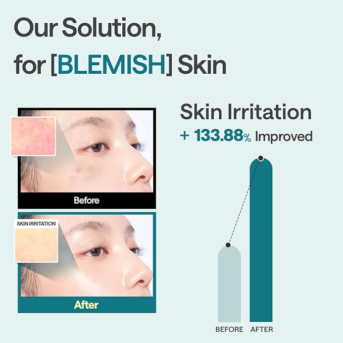 Mediheal Madecassoside Essential Sheet Mask Blemish Repair 4 pcs. 98% Purity Madecassoside & Hyaluronic Acid Included. Enhancing Moisture Barrier & Skin Texture Care. Vegan Formula Sheet Mask