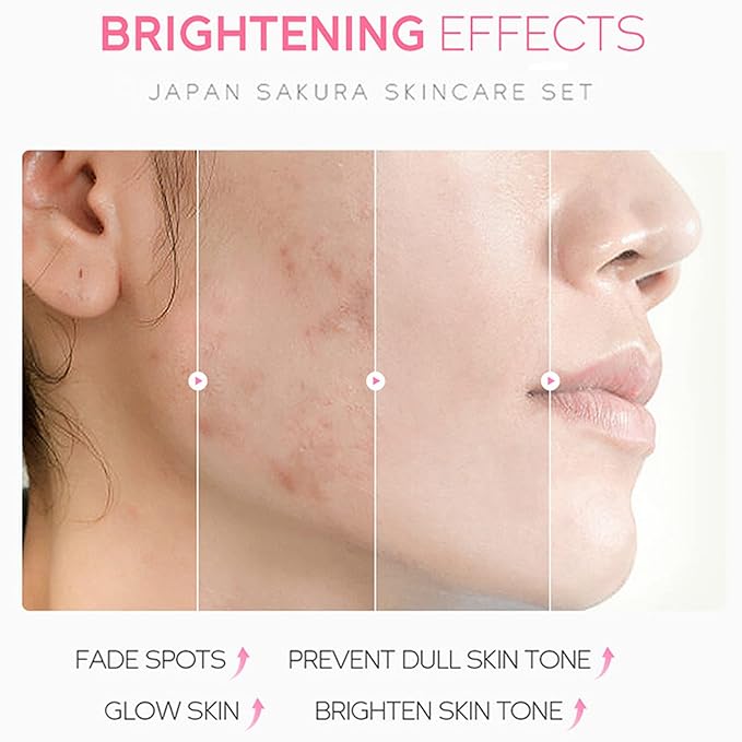 Skin Care Set - Sakura Skin Care Sets & Kits - Women Gift Sets with Cleanser,Serum,Eye Cream,essence Cream - Beauty Products For Women - Skin Care Routine Travel Kit (SetB)