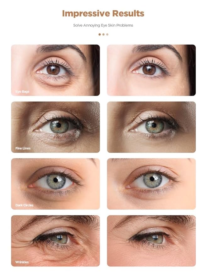 Under Eye Patches, 20 Pairs 24K Gold Eye Patches For Puffy Eyes, Under eye Bags, Wrinkles, Nourish Skin, Eye Masks With Collagen, Hyaluronic Acid for Men & Women Gift (24K Gold)