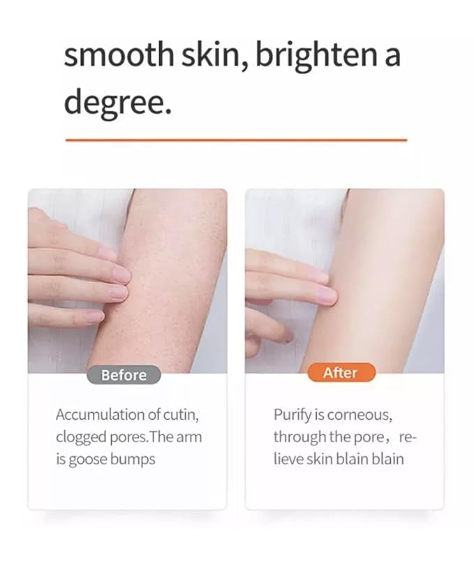 Bright Smooth Niacinamide Pecan Body Scrub – 200mL / 7.04 fl oz – Exfoliating Scrub for Body Acne & Dead Skin – Gentle, Hydrating, Non-Drying Formula for Smooth, Renewed Skin