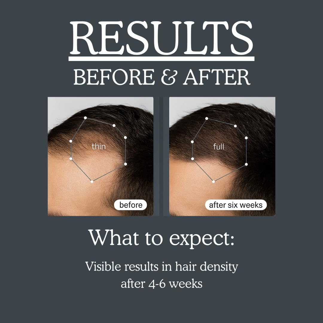 TRENDSTARTER - TEA TREE & BIOTIN THICKENING SHAMPOO & CONDITIONER Set (10.14Fl.Oz ea.) - Argan Oil, Peppermint Oil, Collagen, Quinoa, Aloe, Rosemary, Green Tea, and Saw Palmetto (DHT Blocker)