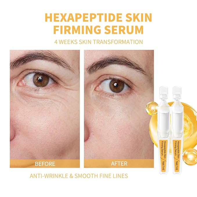 Skin Firming Serum with Acetyl Hexapeptide-8, Hexapeptide-9, Carnosine - Moisturizing, Hydrating and Antioxidant for Fine Lines, 30 Pcs/Box Ampoules