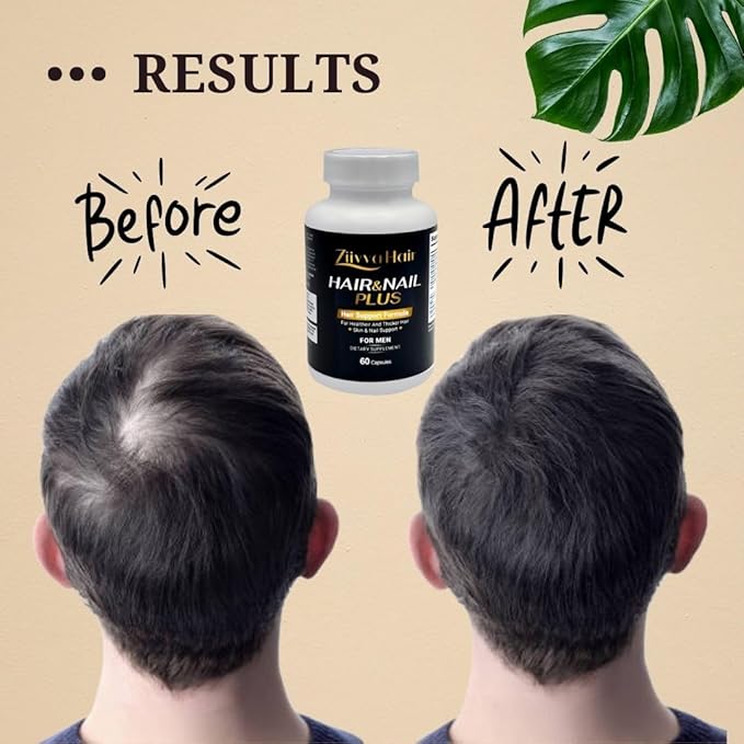 Hair Vitamins for Men - All Natural Vegan Biotin 5000 Mcg Capsules - Hair Supplements for Growth & Thickness - Promote Healthier Hair, Skin, Nails - Hair Growth Supplement Formula