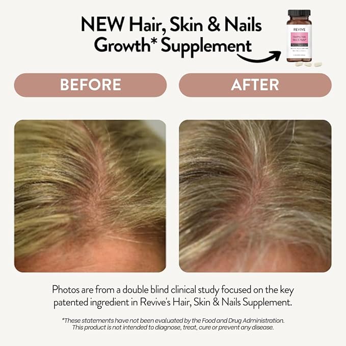 REVIVEEO Healthy Skin, Hair & Nails Supplement by Revive Essential Oils - Supports Healthy Hair with Pantented Form of Biotin - Ashwagandha for Stress Support - Plus Vitamins & Minerals