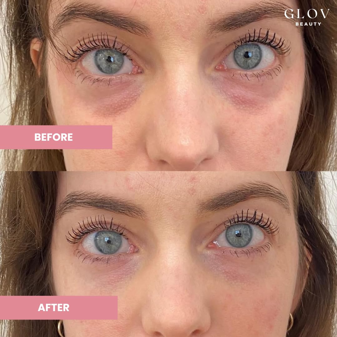 Glov Beauty - Hydrate & Brighten Eye Cream - Anti-Aging Under Eye Cream for Dark Circles, Wrinkles & Puffiness - With Retinyl Palmitate, Sodium Hyaluronate & Niacinamide - All Skin Types