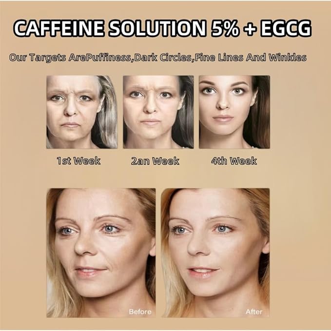 Caffeine Solution 5% + EGCG, Caffeine Eye Serum For Face, Moisturizing Under Eye Solution For Reduces Dark Circles & Puffiness, 30ML (1, 1 PC)