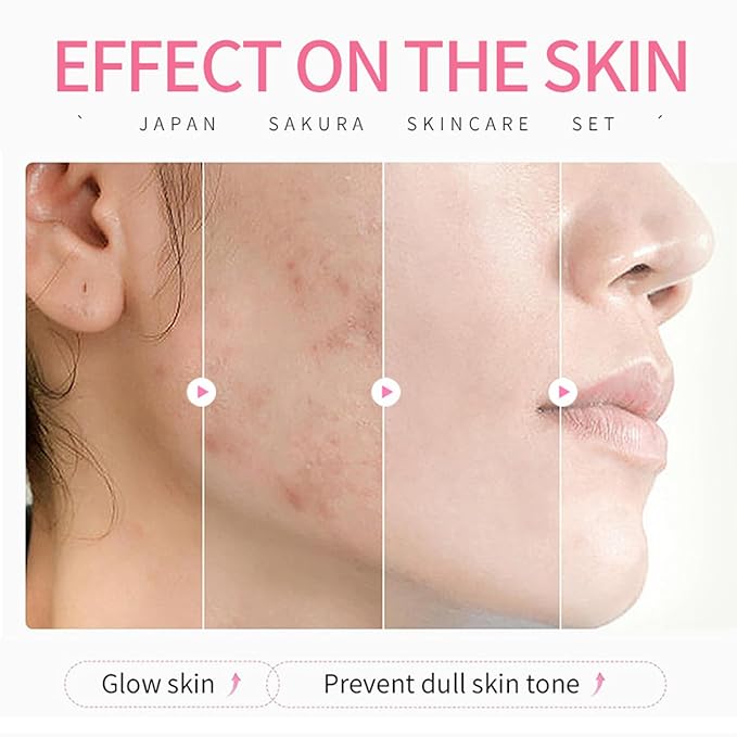 Skin Care Sets for Women/Girls JAPAN SAKURA Beauty Gift Sets Skincare Kit with Cleanser, Serum, Eye Cream, Face Cream Travel Pamper Sets for Women Gifts,Skin Care Sets & Kits