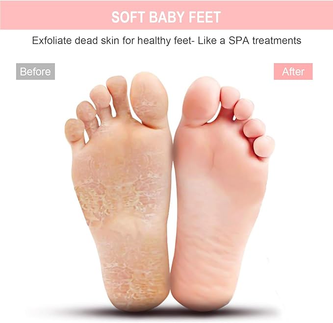 BESKAR XL Large Foot Scrubber Mat for Use in Shower - Shower Foot Cleaner to Eliminate Calluses Dead Skin, Foot Massager Mat for Men & Women to Soothe Achy Feet, Non Slip Suction Cups