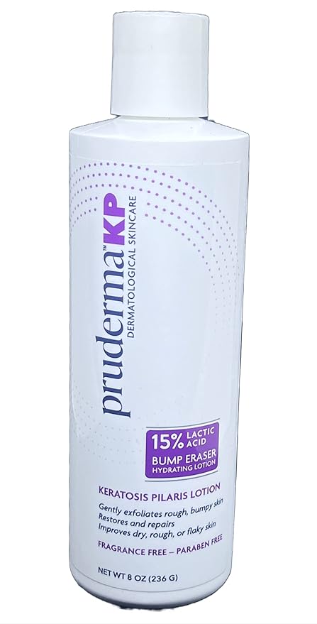 KP Keratosis Pilaris Treatment, KP Bump Eraser Hydrating lotion, Bumps Be Gone, Moisturizing and exfoliating lotion For Rough and Bumpy Dry Skin For Body, 8 Oz