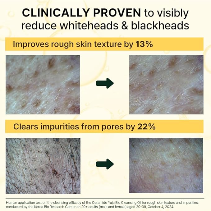 Ceramide Yuja Cleansing Oil (200ml) – Deep Pore Cleansing, Hydrating with Yuzu & Ceramide, Non-Comedogenic, Removes Waterproof Makeup, Ideal for Acne-Prone Skin (6.76oz)