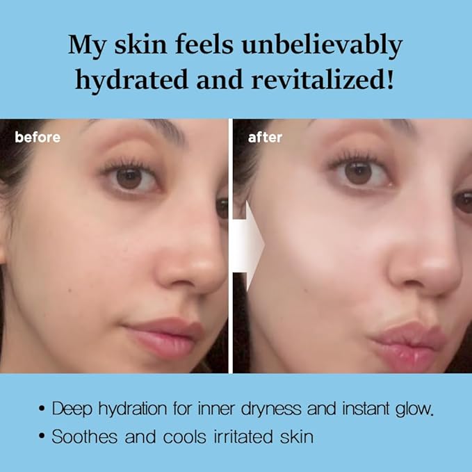 Nightingale Ecto-hyaluronic Soothing Mask, Hyaluronic Acid, Betula Alba Juice, Ectoin, Korean Hydrating Facial Mask, Alcohol Free, Korean Skin Care