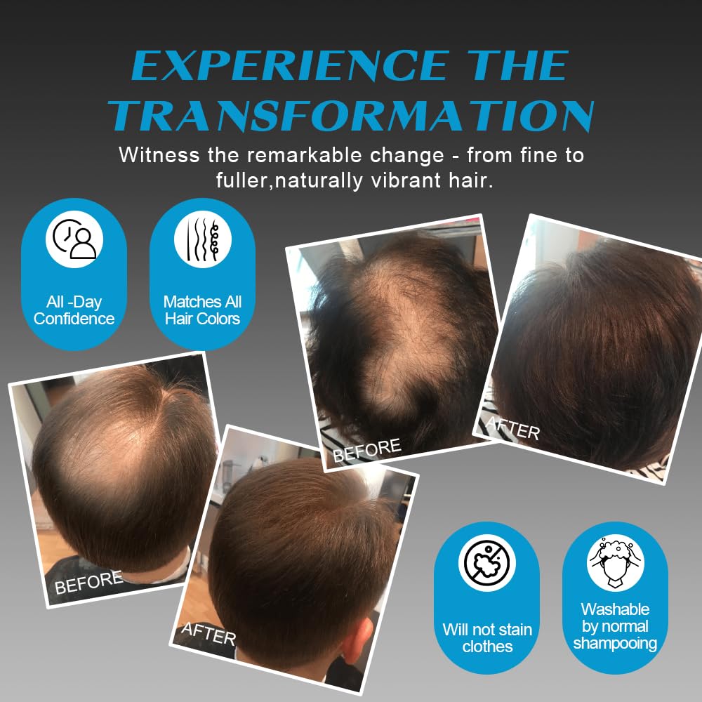 Hair Building Fibers 27.5g (Black) Hair Fibers for Thinning Hair for Men & Women – Conceals Fine Hair, Bald Spots, Hair Loss – Instantly Fuller Thicker Hair Look – Hair Concealer Powder