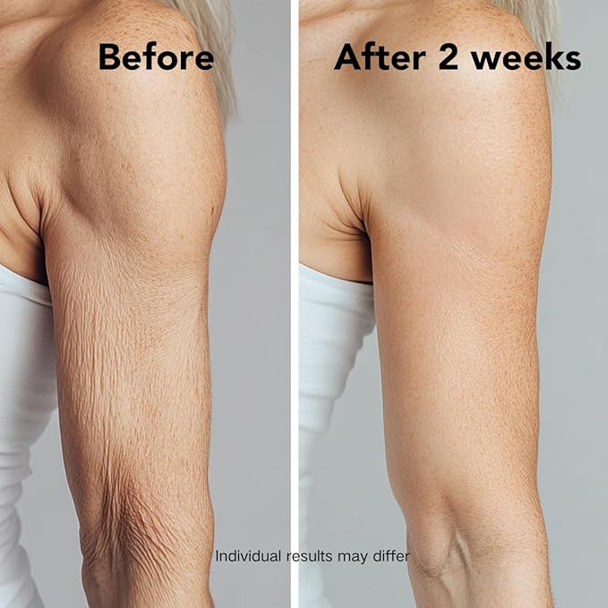 Ultra-Size Firming Retinol Body Lotion for Crepey Skin & Keratosis Pilaris with 0.05% Retinol, AHA, Collagen, Body Cream, Anti Aging Moisturizer 10.14 fl oz