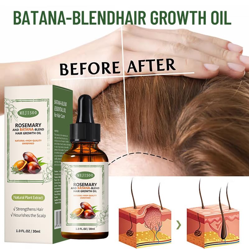 Organic Batana Rosemary Oil for Hair Growth & Anti-Hair Loss, Natural DHT Blocker Scalp Treatment for Thinning Hair, Nourishing Dry Scalp & Strengthening Follicles Cold-Pressed, Non-Greasy, 1 fl oz