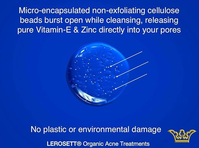 LEROSETT® Clear Skin Face Wash – Gentle Gel Cleanser with 60% Aloe-Rich Botanicals, 4% Glycolic Acid & Vit-E Microbeads – Fights Breakouts, Unclogs Pores, Balances Oil – Spa-Grade, Vegan – 6.7oz