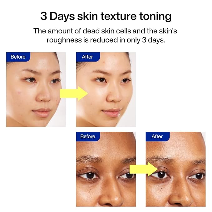 IOPE Gluta Vitamin C Brightening Serum | 25% Pure Vitamin-C and 1,000ppm Glutathione, Anti-Aging and Anti-Oxidant, Reduces Dark Spots, Korean Skincare, 0.78oz.