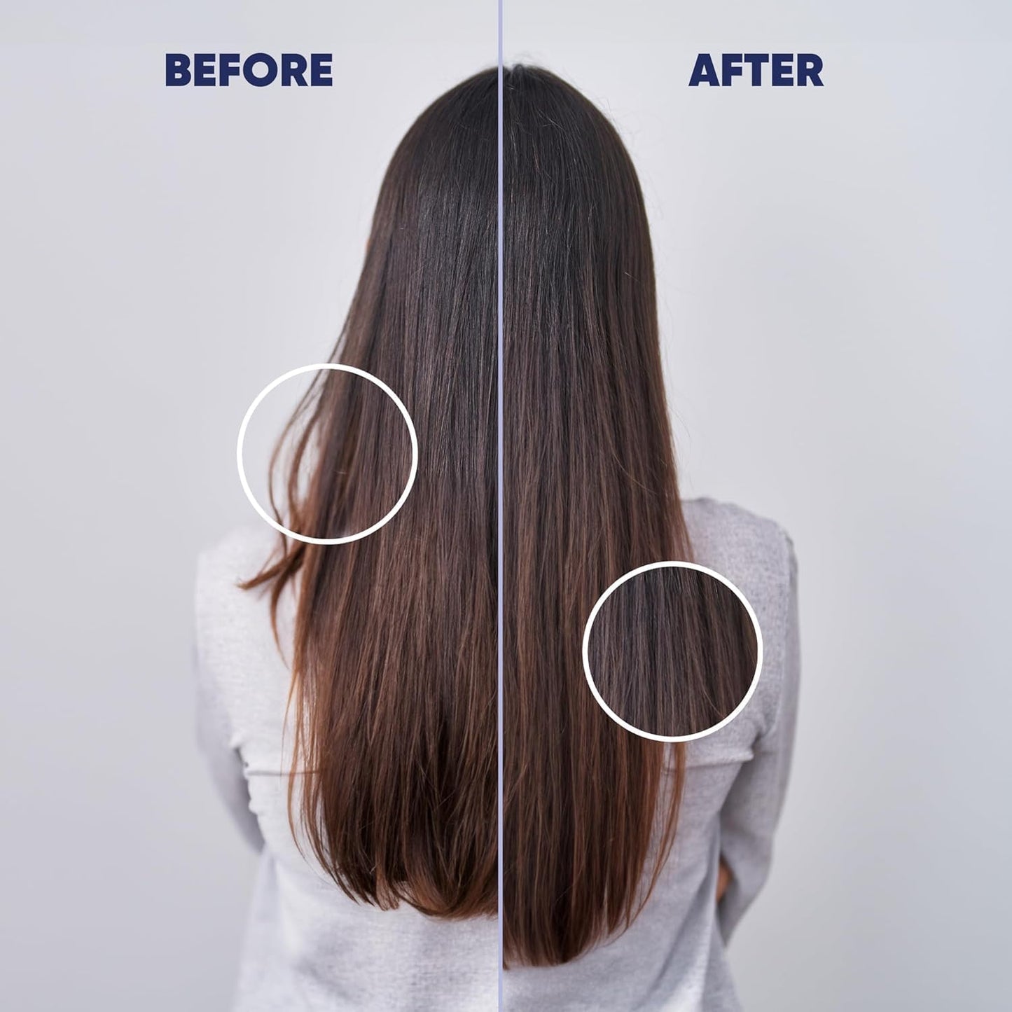 MOERIE Ultimate Hair Growth Serum for Natural Hair Regrowth & Thickening - Anti Thinning & Hair Loss Treatment for Women - Rapid Hair Growth Products (1.69 Fl Oz (Pack of 3))