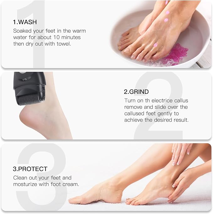 Electric Feet Callus Removers Rechargeable,Portable Electronic Foot File Pedicure Tools, Electric Callus Remover Kit,Professional Pedi Feet Care Perfect for Dead,Hard Cracked Dry Skin Ideal Gift