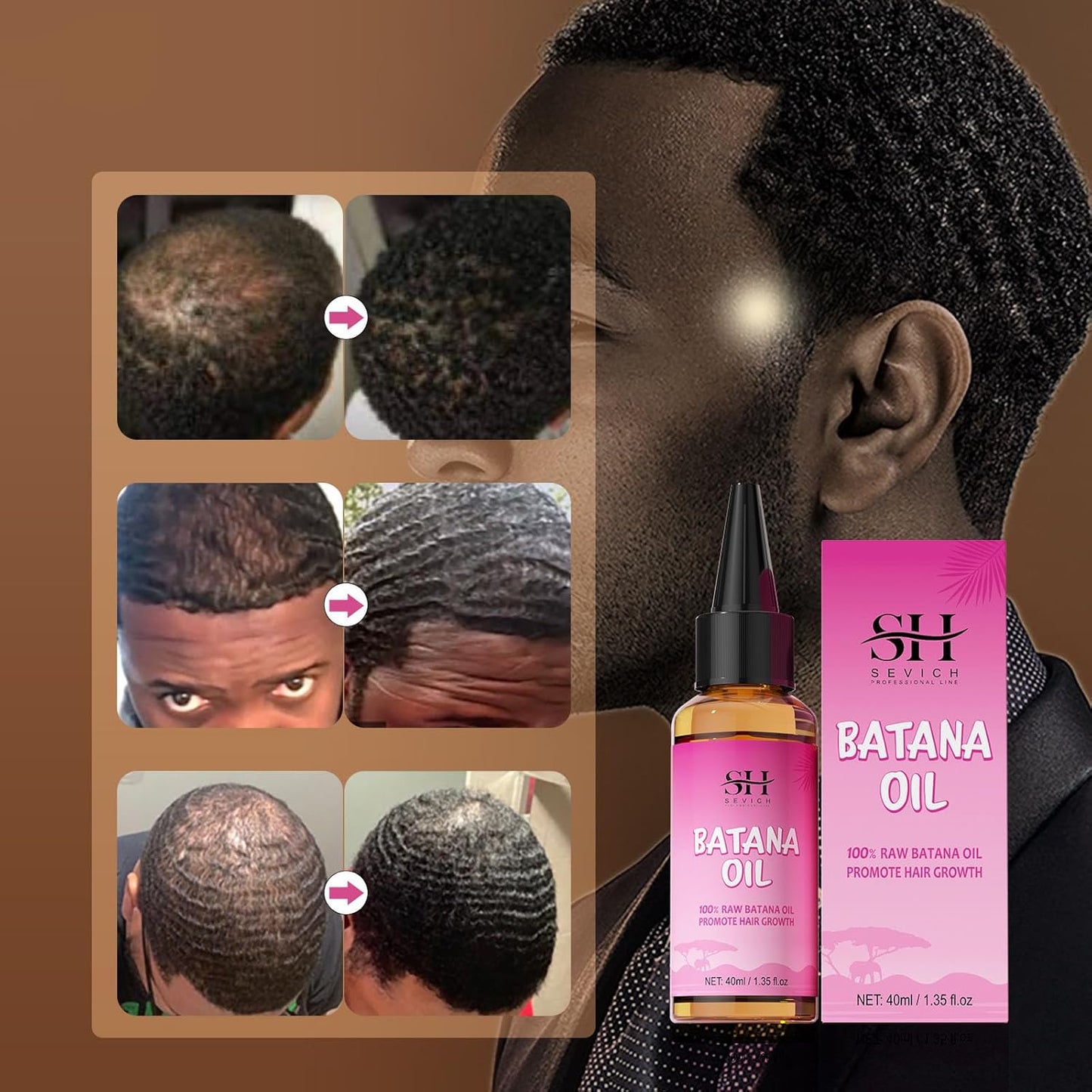 SEVICH 100% Natural Batana Oil for Hair Nourishment: Repair Damaged Tresses, Promote Hair Growth, Suitable for All Hair Types - 1.36 fl.oz