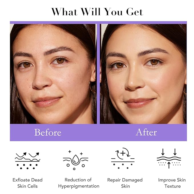 Daily Essential Skincare Set, Glycolic Acid+Vitamin C Facial Skin Care Sets & Kits, 5 In 1 Skin Care Gifts for Women w/Exfoliates Face Wash, Toner, Serum, Moisturizer, and Mask, Vegan & Cruelty-Free