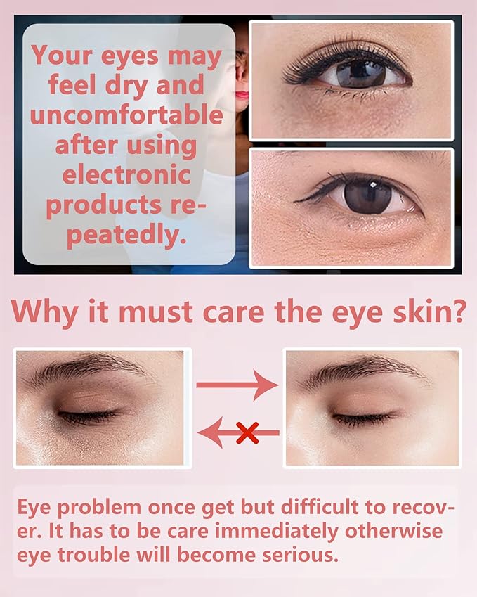 Under Eye Patches (60Pcs) - Update Eye Mask Rose Extract, Eye Treatment Mask, Under Eye Bag Treatment, Eye Mask for Puffy Eyes,Anti-Wrinkle,Under eye Dark Circles, Women's Mother's Day Gift for Women