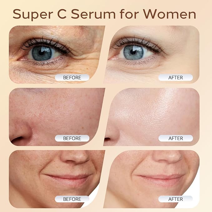 Turmeric Vitamin C Facial Serum – Turmeric Extract Super Vitamin C for Women Men, Hyaluronic Acid for Face, Firming Anti Aging Wrinkle -1 Fl Oz. (1PC)