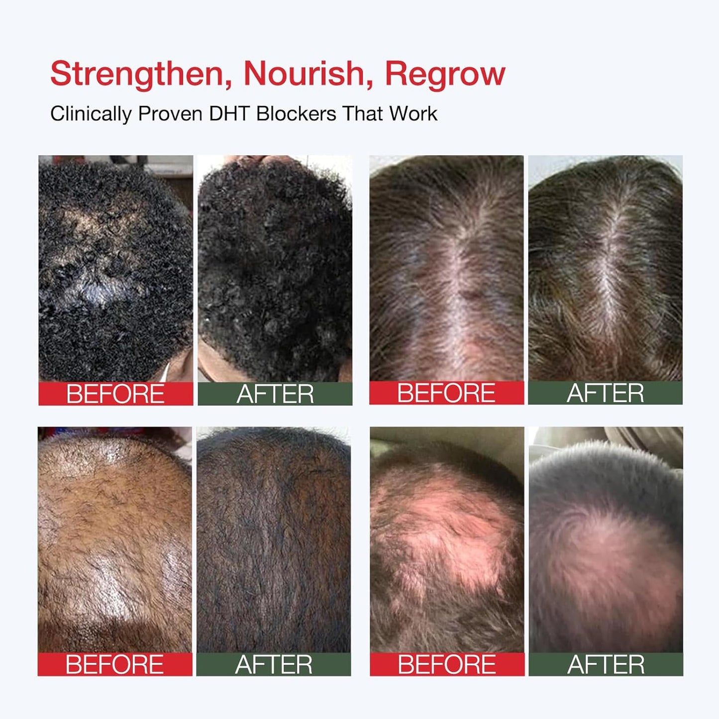 Professional Strength Hair Restore Shampoo, 7 Fl Oz Extra Potent Hair Loss Shampoo for Women & Men, Hair Regrowth Strengthening Biotin Boost Nourishes Scalp and Stimulates Growth