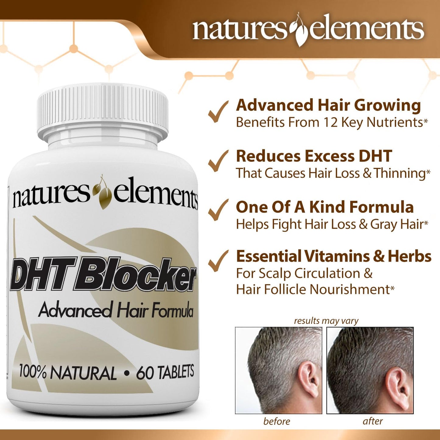 DHT Blocker – Herbal Formula with Saw Palmetto, Fo-Ti & Beta-Sitosterol – Supports Hair Regrowth & Gray Hair Reversal – 60 Tablets – Non-GMO, Vegetarian