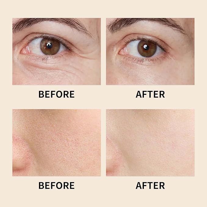 Frankincense Resin Oil, Natural Castor and Jojoba Oils Cold Pressed Serum Face Hydrates Anti-Aging Organic Frankincense Oil. -2Pcs