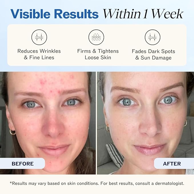 LilyAna Naturals Retinol Cream - Anti-Aging Moisturizer for Face & Neck, Made in USA, Wrinkle Reduction - 1.7oz, 2 Pack