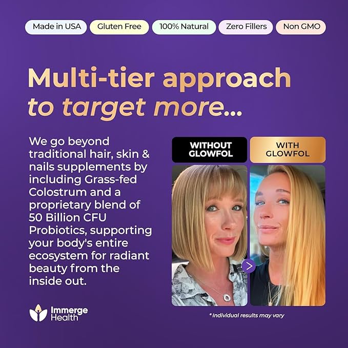 Biotin Collagen Supplement with Probiotics, Colostrum, Hyaluronic Acid and Keratin for Faster Hair Growth | Hair Skin Nails Vitamins For Women and Men | Biotin Hair Growth Supplement | 120 Capsules