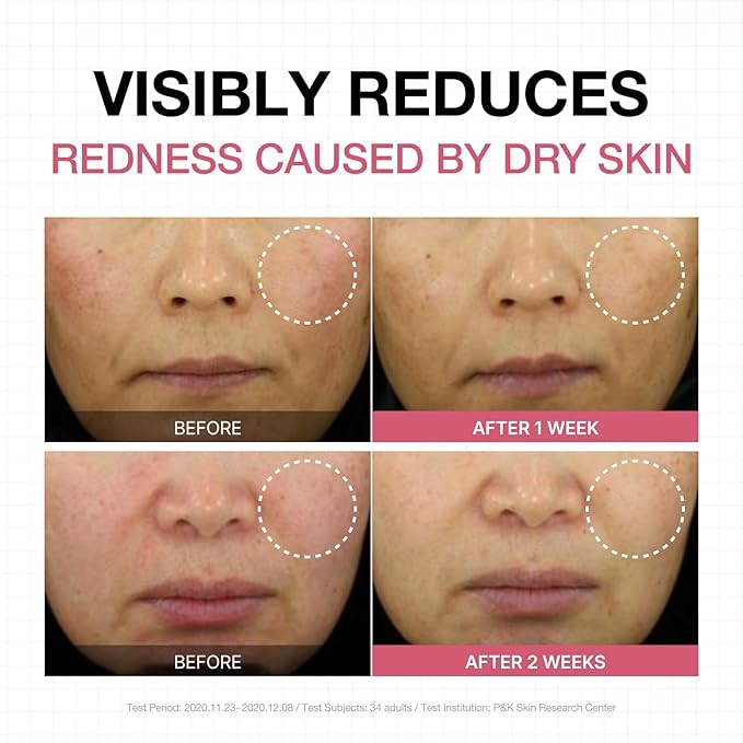 Physiogel Calming Relief Face and Body Lotion, Reduces Redness in just 3 days, Moisturizer for Dry, Red, Itchy, Sensitive Skin, Korean skin care, Fragrance-Free, Non-Comedogenic, Dermatologist-Tested