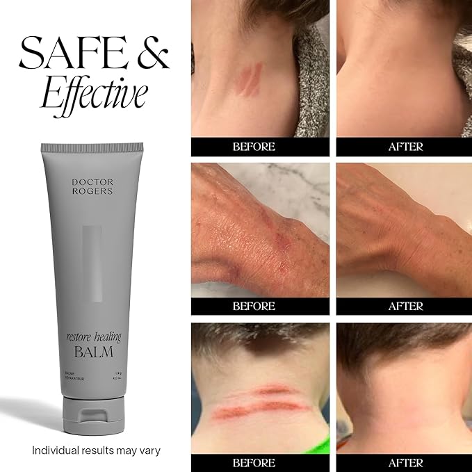 Doctor Rogers Restore Healing Balm. Multi-Purpose Healing Ointment & Moisturizing Eczema Relief Gel. Protects & Soothes Injured, Sensitive & Dry Skin. 4 Ounce (114 g) Tube