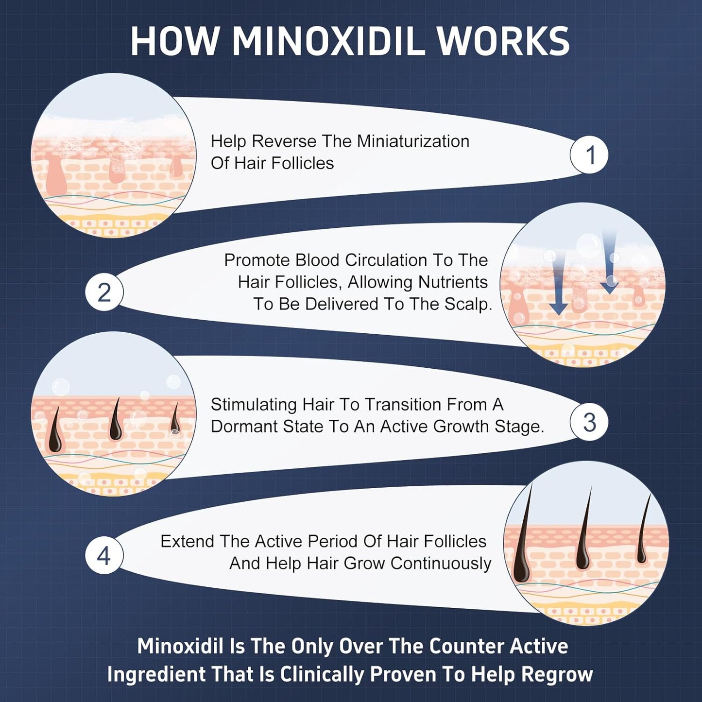 5% Topical Minoxidil Foam, Minoxidil for Men and Women, Infused with Biotin, Hair Growth Treatment, Supports Thicker, Fuller, Healthier Hair & Beard (Foam,6 x 2.11oz,6 Month's Supply)