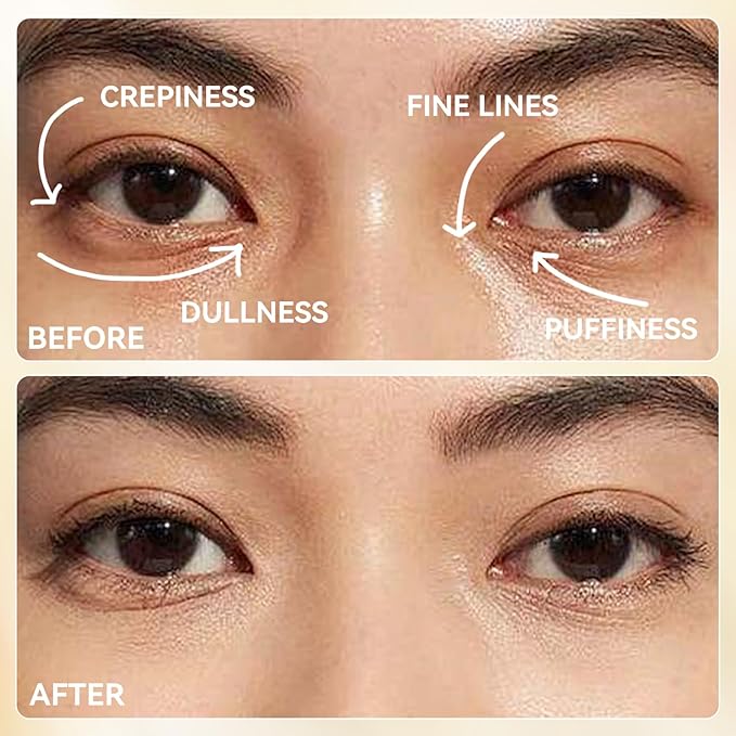 LANBENA Full-Around 24K Gold Eye Patches, Rapid Reduction Eye Essence, Visibly Reduces Under EyeBags, PuffyEyes, Wrinkles, Dark Circles, Fine Lines, EyeSkin Care Treatment Set (6 Pairs, 0.27 FL.OZ)