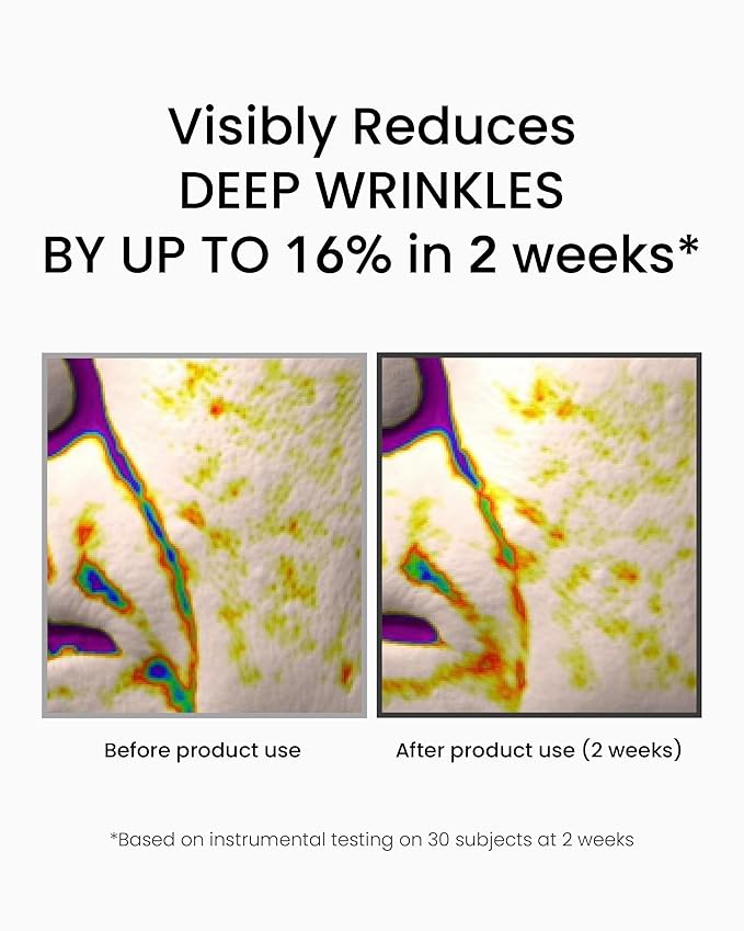 Korean Retinol Serum for Face (1fl oz) – Youth Rejuvenating Face Ampoule for Improving Fine Lines & Reducing Pigmentation, Skin Care for Day & Night Use. Vitamin C, Niacinamide, Peptide