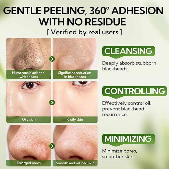 LANBENA 3.0 Bamboo Charcoal Nose Pore Strips, UPGRADED Blackhead Remover Mask for Stubborn Blackheads, Dirts, Whiteheads, Oil and More, Face Pore Purifying Cleansing, Aloe Vera, Volcanic Ash