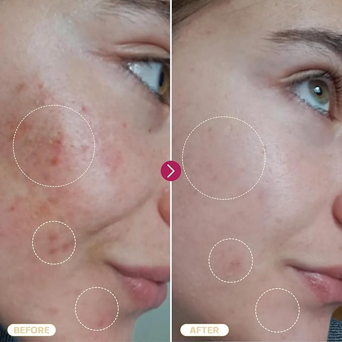 BASE LABORATORIES Hypochlorous Acid Spray for Face & Skin | 8oz | Magic Facial Spray Daily Skin Repair Solution for Sensitive Skin, Redness, Irritations, Eczema | Hypochlrous HOCL Molecule Spray | 2PK