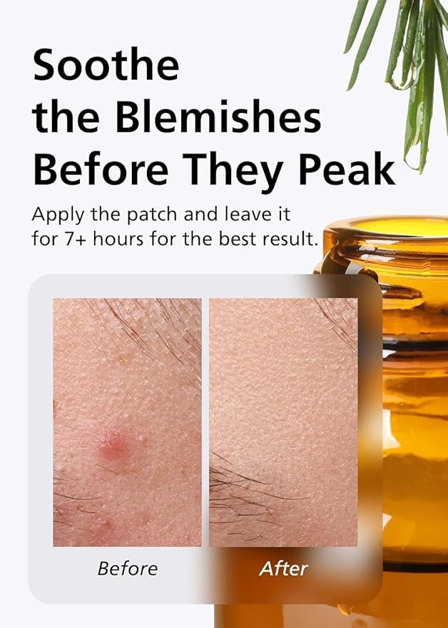 EasyDerm Pimple Patch Duo – 84 Counts | Beauty Hydrocolloid Patch(42ea) + Relief Invisible Patch(42ea) Tea Tree Oil Spot treatment for Zit, Blemish, and Breakout Care | Vegan & Cruelty-Free