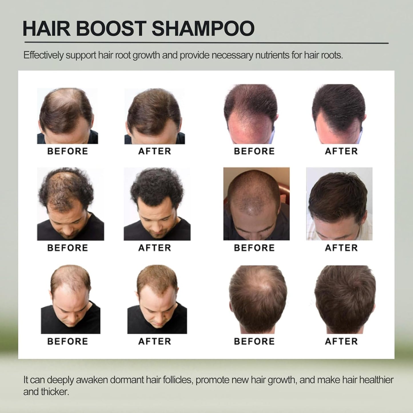 Root Activator Shampoo for Men,Hair Regrowth Root Activator Shampoo for Hair Loss and Thinning Hair, Nourish and Shine Revitalizing, Black(3pcs)