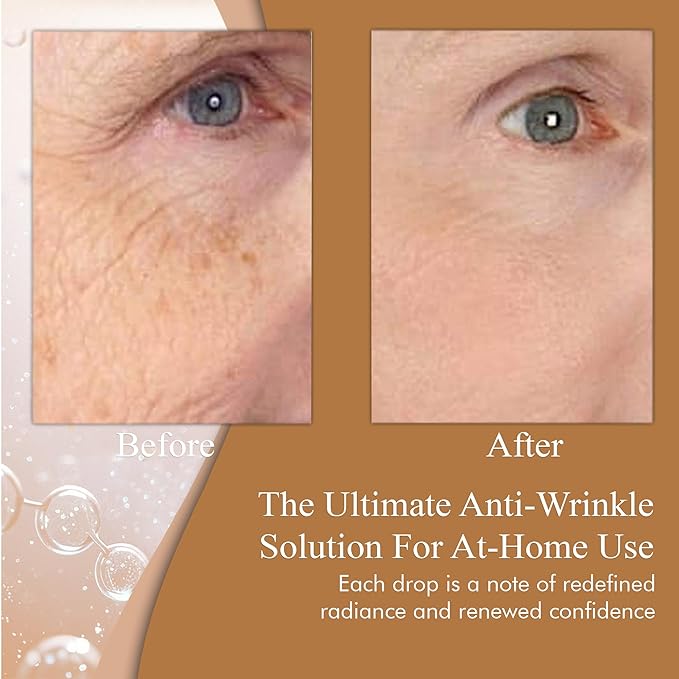 Extreme Retinol Serum for Face - Rapid Wrinkle Repair Face Moisturizer for Women, Physicians Formula, Retinol Serum 3% with Hyaluronic Acid, Home Safe, (1 fl oz)