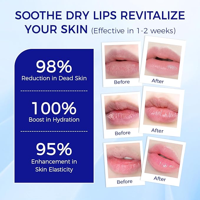 2PCS, Medicated Lip Balm w/Organic & 100% Natural Ingredients, Squeeze Tube Lip Butter SPF 25+ Long-Lasting Moisturizing Overnight Lip Mask Gentle Exfoliation Extreme Dry Lips Treatment