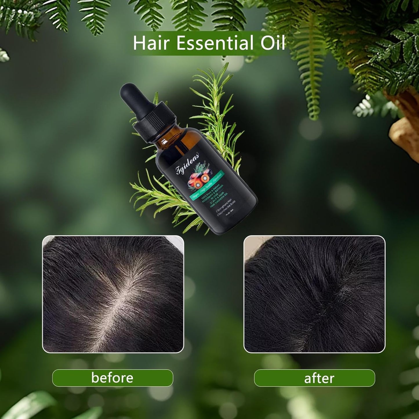 Tgideas Rosemary Batana Oil - Organic Hair Growth -for Scalp & Hair Strengthening - All Hair Types Treatment Oil - Eyebrow & Eyelash Nourishing