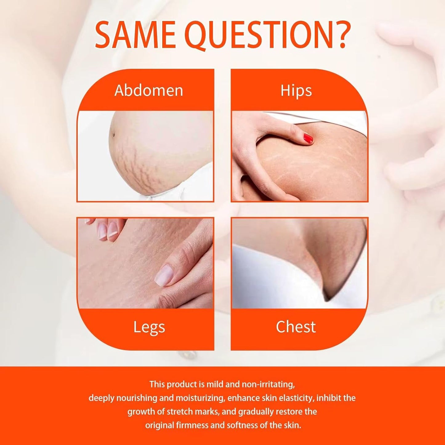 Stretch Mark Pregnancy Oil, Natural Oil Skincare Body Oil Serum for Scars and Stretch Marks, Face with Vitamin E & A for Sensitive Dry Skin and Body Moisturizer