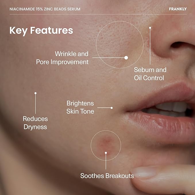 FRANKLY Niacinamide 15% & Zinc Beads Serum: Acne & Dark Spots Care, Oil Control, Even Skin Texture & Glow | Vegan & Cruelty-Free | Non-Comedogenic All skin types Korean Skincare | 1.01 fl.oz