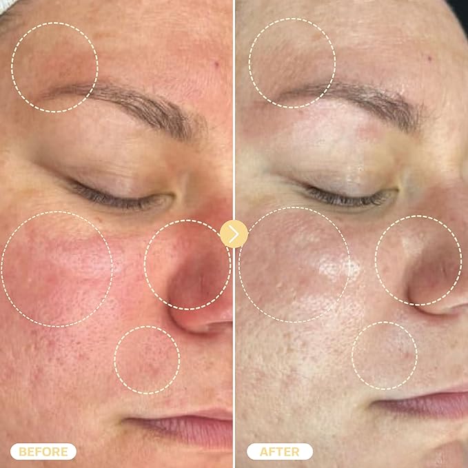 BASE LABORATORIES Hypochlorous Acid Spray for Face & Skin - Travel Size - Magic Facial Toner Spray & Cleaner - Skin Repair Solution helps reduce redness, Irritations, acne - HOCL Molecule Spray 2oz