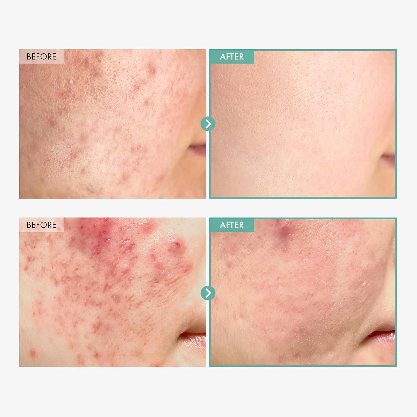 TOSOWOONG Dexpanthenol Cream, 170,000ppm B5 Panthenol, Madecassoside, Centella Asiatica for Skin Barrier Repair, Facial Moisturizer, Soothing, Hydrating, Korean Skincare, 60ml, 2.02 fl. oz.